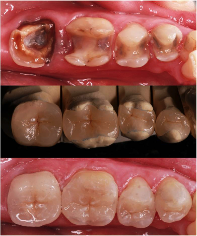 Rehabilitación oral bajo apoyo anestesiológico - Ratón Pérez